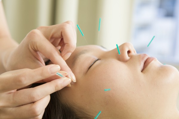 kosmetische Akupunktur